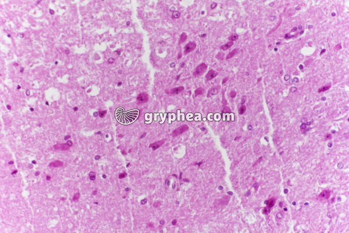 Hypothalamus CL x100 - gryphea.org